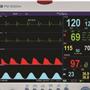 瑞博 多参数监护仪 PM-9000A+